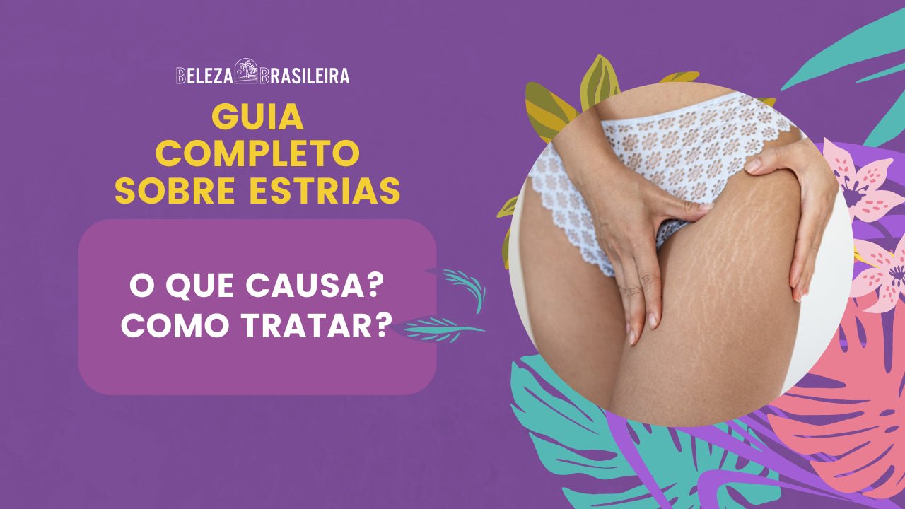 Guia Completo Sobre Estrias: O que causa? Como tratar? - BELEZA BRASILEIRA