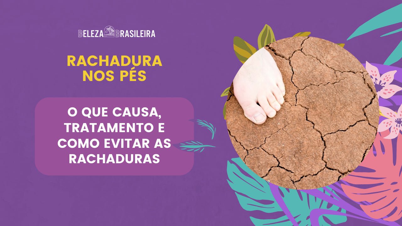 Rachadura nos Pés: O que Causa, Tratamento e Como Evitar as Rachaduras - BELEZA BRASILEIRA