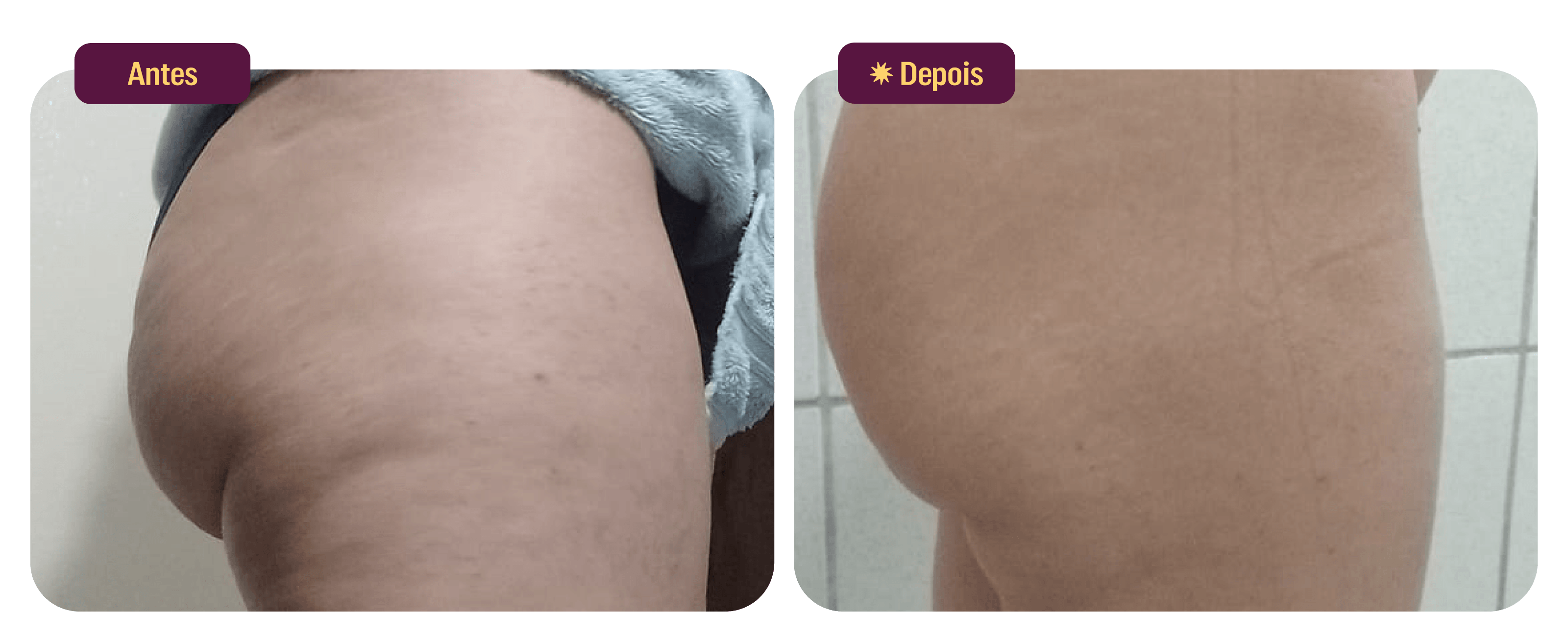 files/Antes-Depois-Uso-Cliente-2-Desk.png