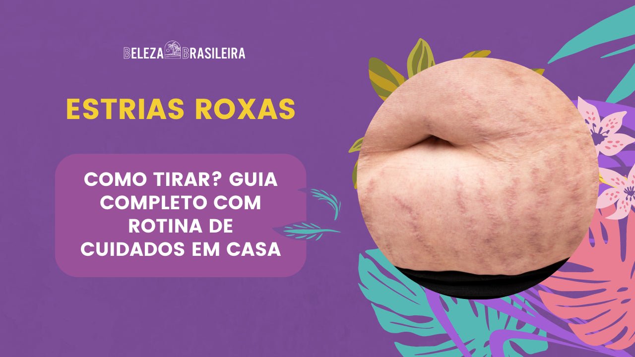 Estrias Roxas: Como tirar? Guia Completo Com Rotina de Cuidados em Casa - BELEZA BRASILEIRA