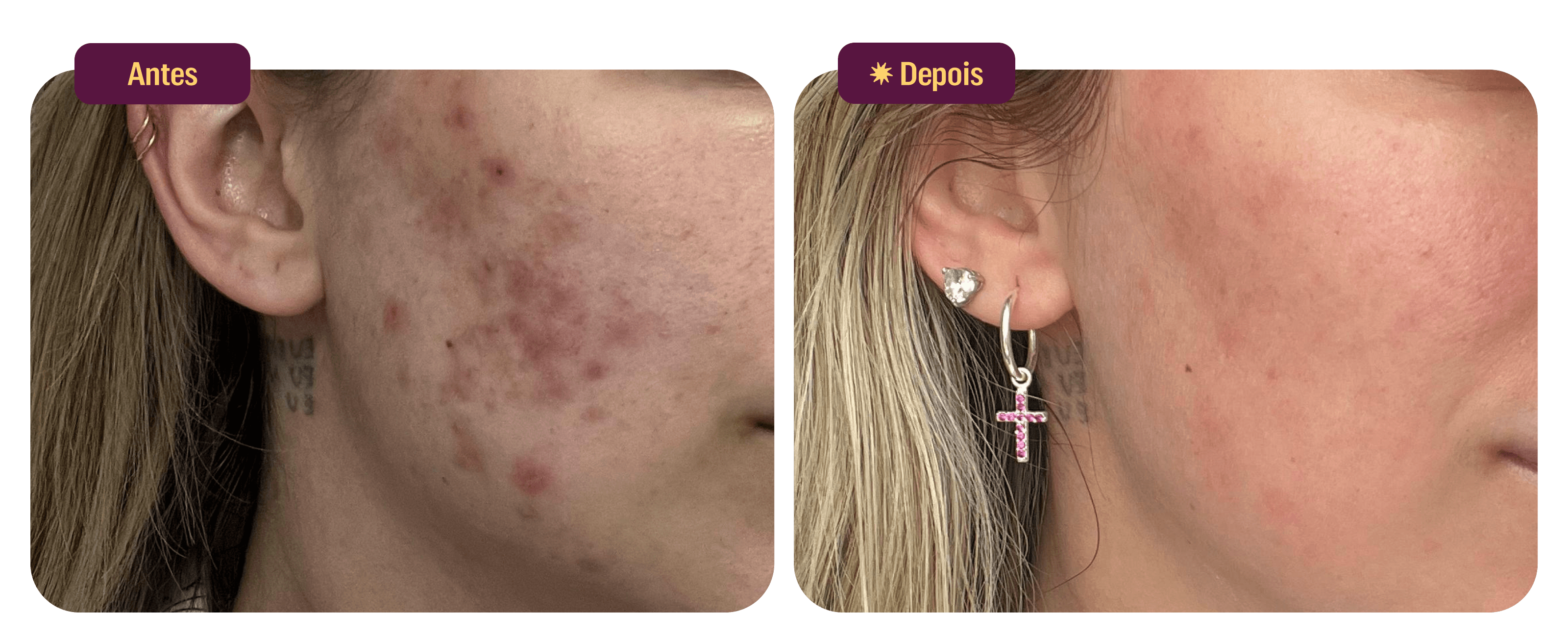 files/Antes-Depois-Uso-BB-Clear-Desk.png