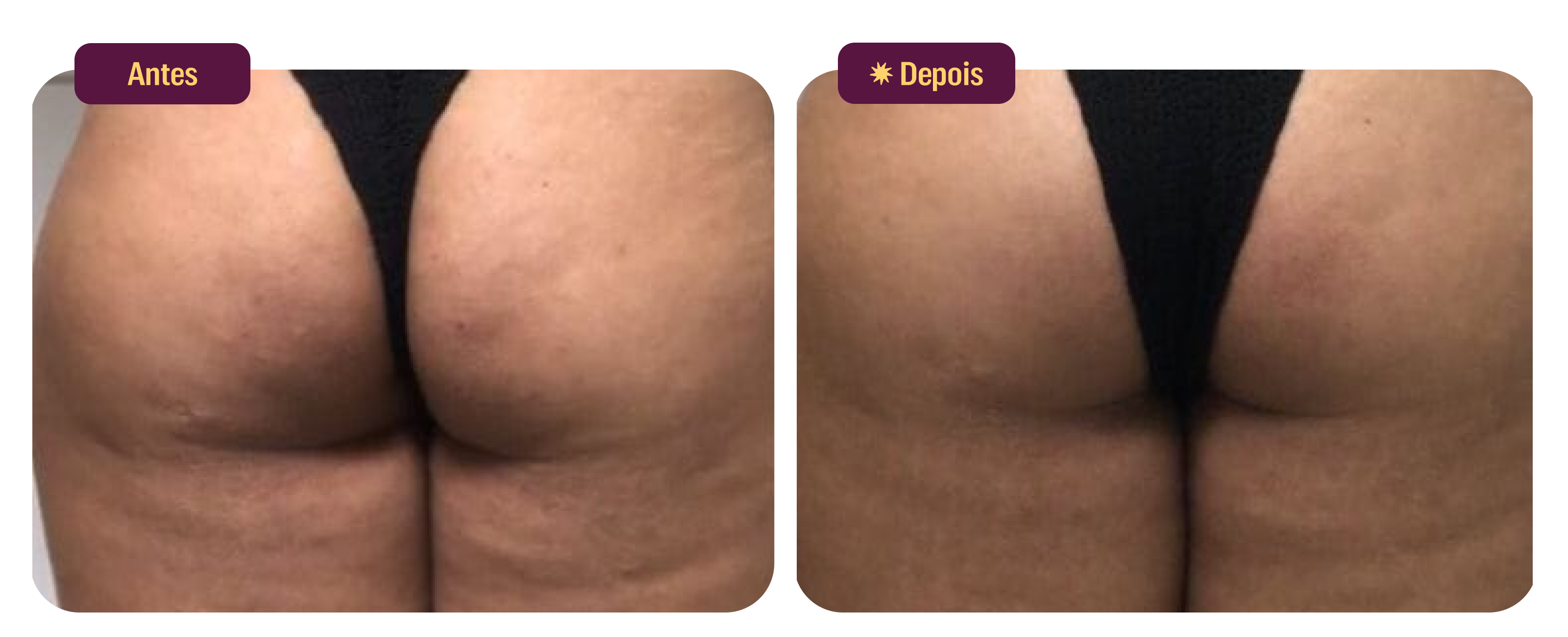 files/Antes-Depois-Uso-Ianaline-2-Desk.png