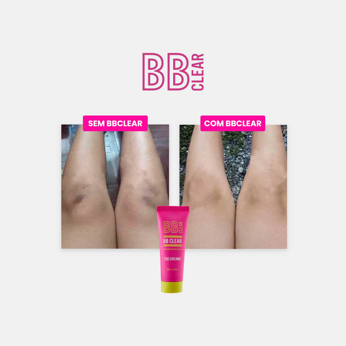 BB Clear Clareador de Manchas - BELEZA BRASILEIRAclareador para pele