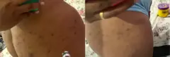 Antes e depois 2